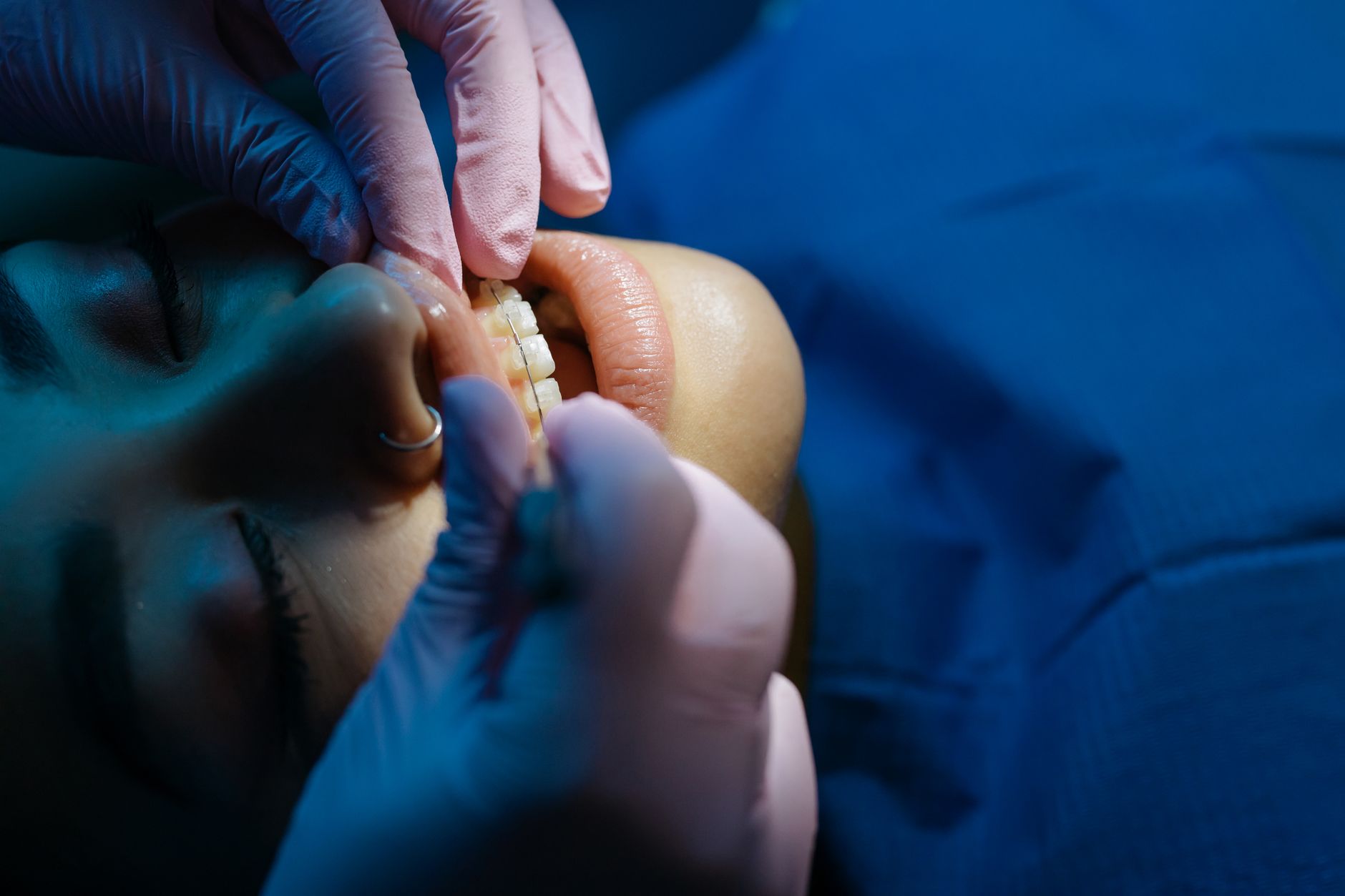 Dentist examining a patient teeth under bright clinic lights