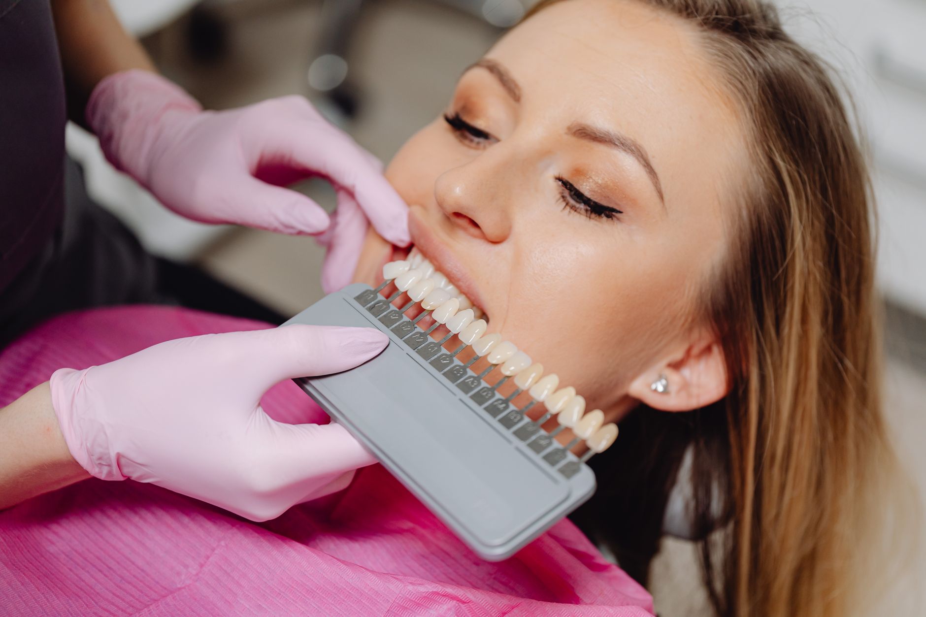 Dentist holding a tooth shade guide next to a patient to compare whitening results