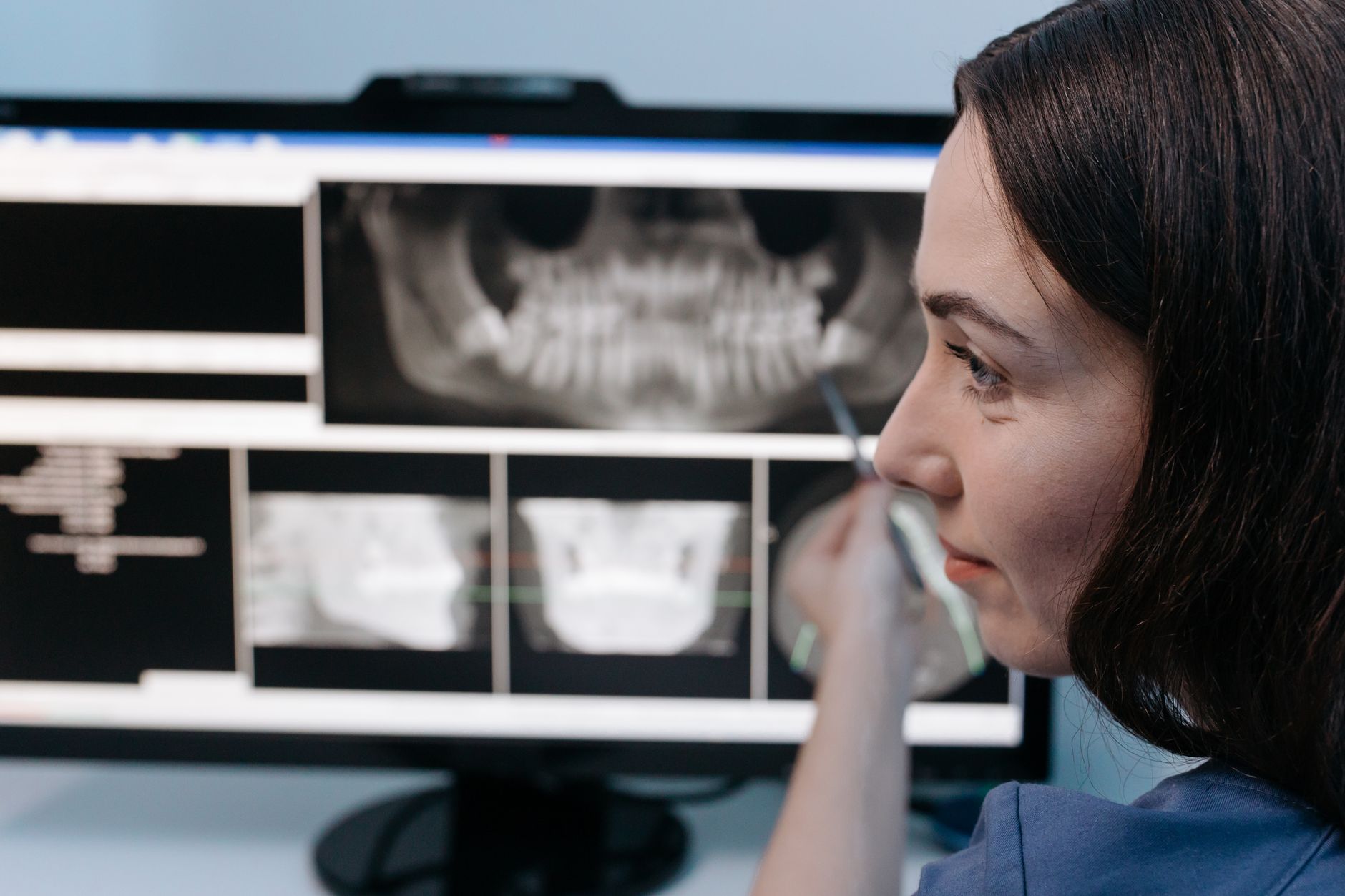 Dentist reviewing a digital dental x-ray on a computer screen